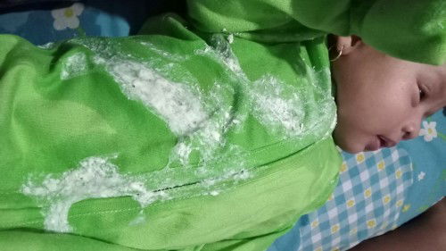 Muntah / gumoh banyak