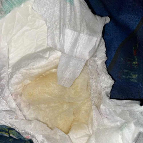 สอบถามค่ะแม่ๆ