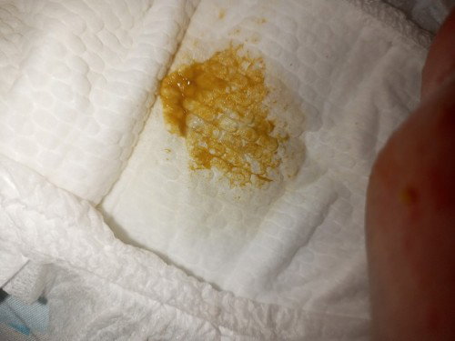 Watery poops