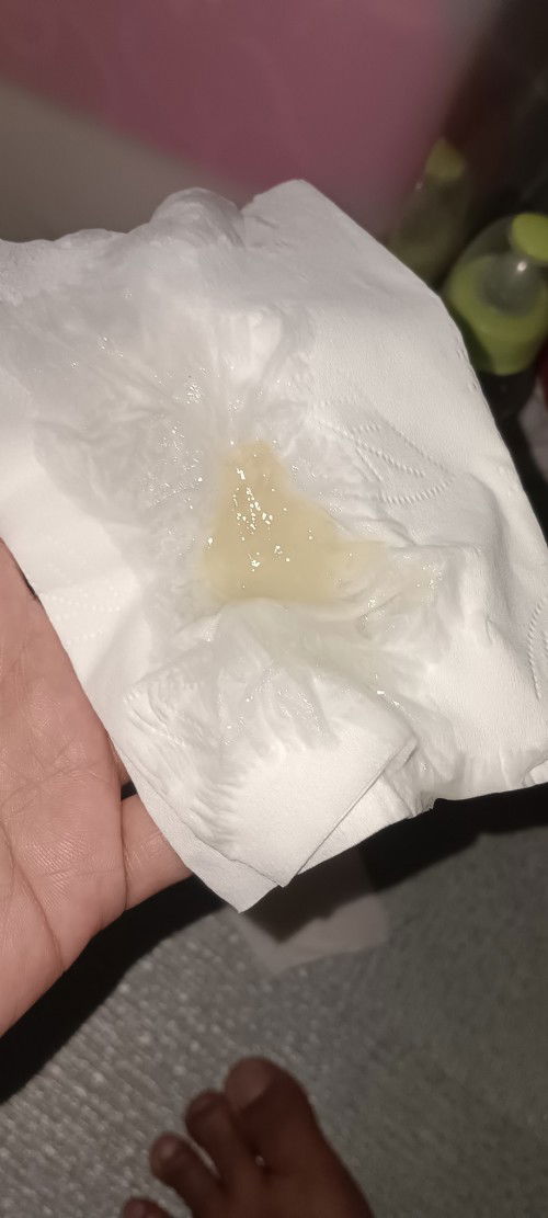 Discharge mucus plug