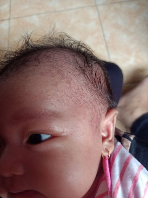 bun mau tanya kalo kaya gini yang bagus make apa ya buat bayi 2 bulan