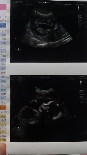 น้ำหนักเท่านี้ปกติดีมั้ยคะ