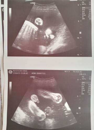 29week1day