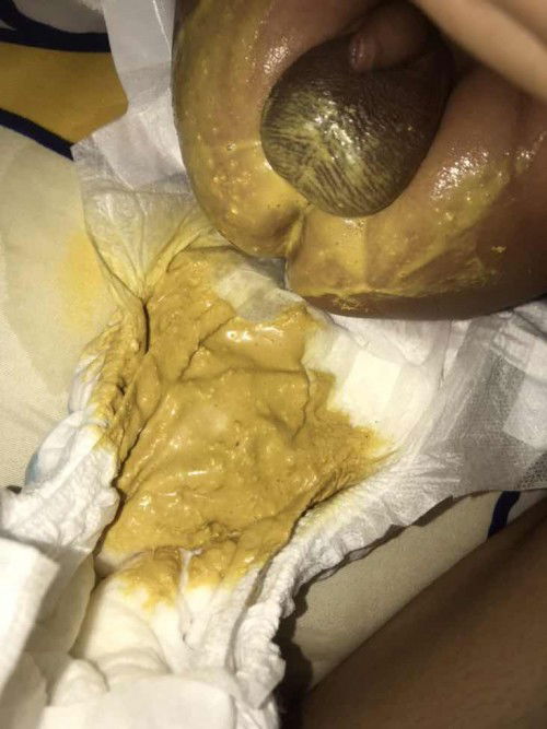 ขอประสบการณ์จากเเม่หน่อยค่ะ