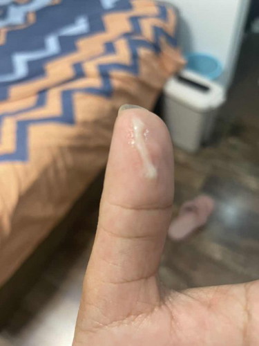 mucus plug