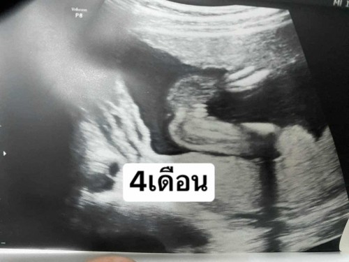 สอบถามเพศค่ะ