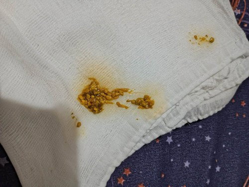 BABY POOPS - Normal ba?
