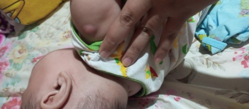 hi mga mii ano po b pwede pantanggal ng pantal ni baby malaki po kasi pabilog..TIA