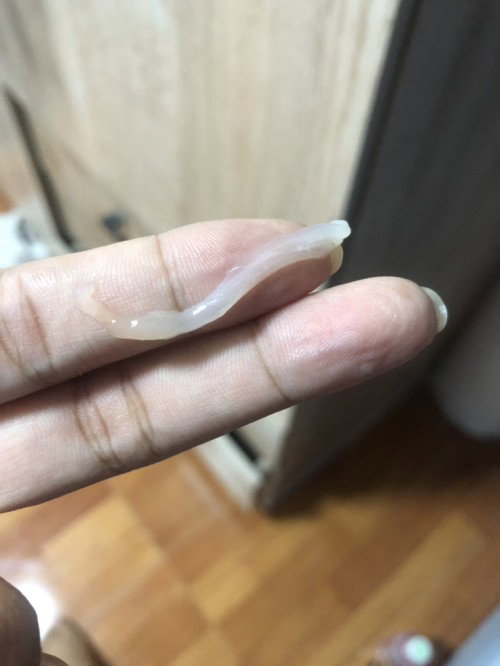ตกขาวหรือมูกคะ