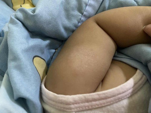 น้องเป็นอะไรค่ะแบบนี้