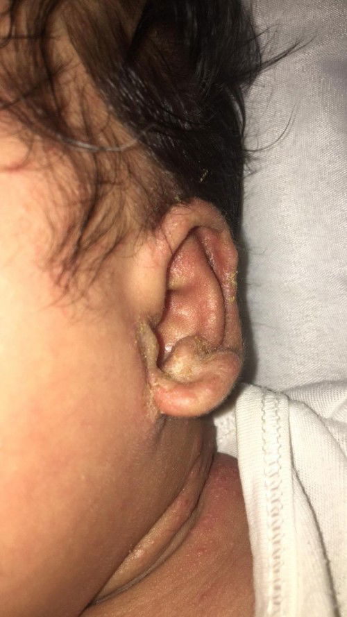 1 month po ngayon yung baby ko