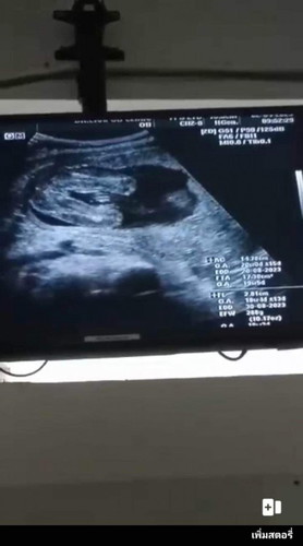 แม่ๆช่วยดูหน่อยจ้า