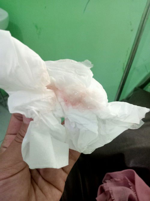 Usia 38week keluar lendir darah