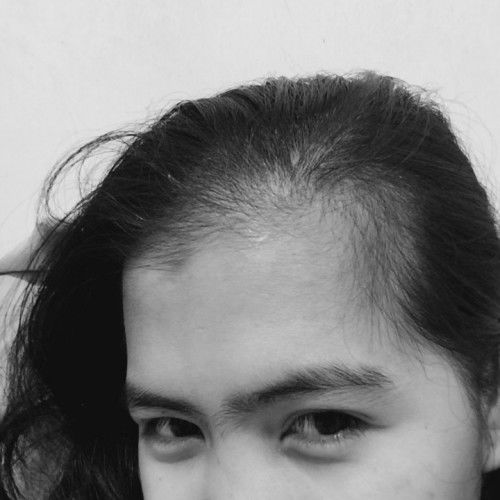 Hair. Hair. Everywhere.