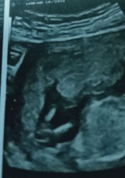 หญิงหรือชายค่ะ