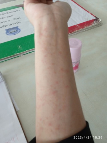 36วีค มีผื่นขึ้น
