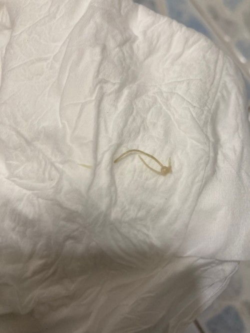 บ้านไหนเป็นบ้างค่ะ