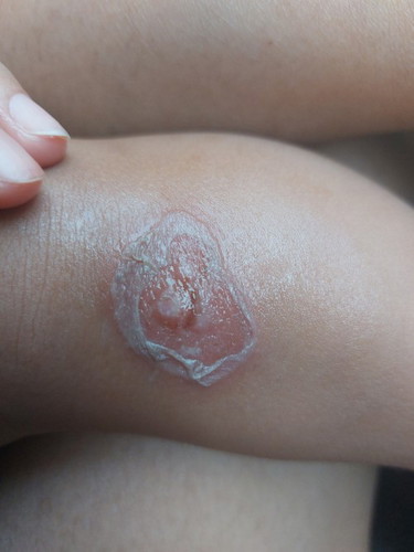 ขอรบกวนแม่ๆทุกๆท่านหน่อยค่ะ