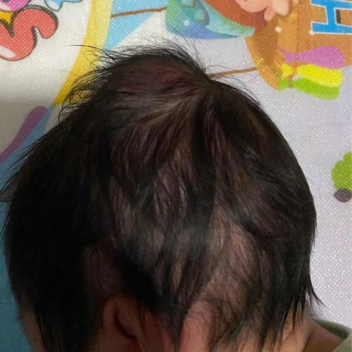 ลูกไครเคยเป็นแบบนี้บ้างคะ