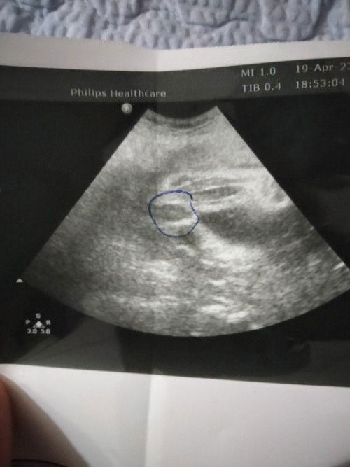 หมอบอกเป็นเพศหญิง