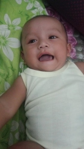 Rambut anak masih agak botak