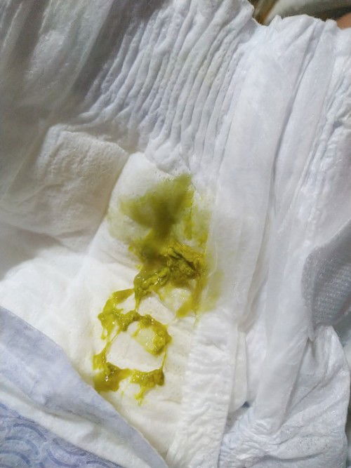 2 months and 14 days poop/tae