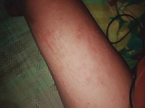 ANONG GAMOT DITO MAKATI SYA TAS NAGKAGANYAN NALANG BIGLA