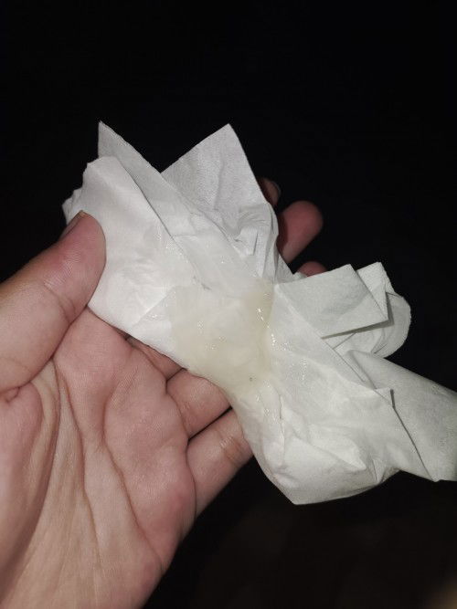 Keluar lendir jel hamil 38week