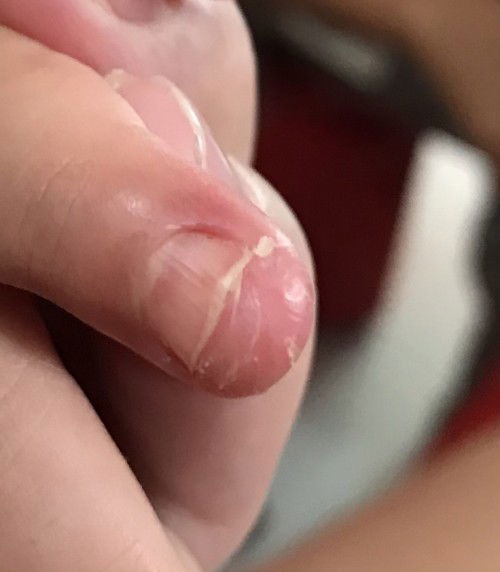 Patulong naman mga mommy