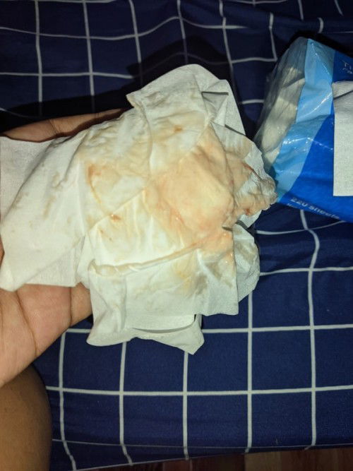 Flek Darah Berwarna Coklat  di 37 week