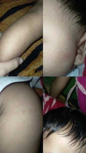 Bayi 5 bulan