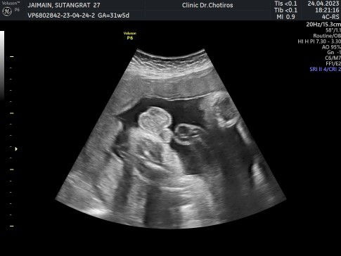 ขออณุญาตอวดลูกชายค่ะ😊