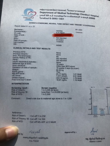 ตรวจดาวซินโรดม