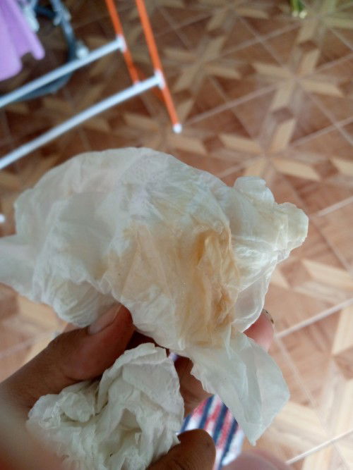 น้ำอะไรตกขาวหรือเปร่า