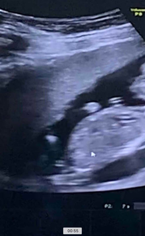 แม่ๆช่วยดูหน่อยค่ะ ชายหรือญ