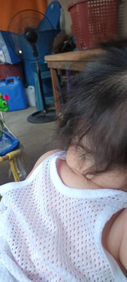 Yan  baby ko mataba normal lang po ba di pa masydo mabalance leeg niya? Tsaka may gnyan po sa batok?