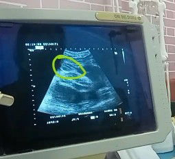 แม่ๆคิดว่าลูกสาว หรือ ลูกชายค่ะ