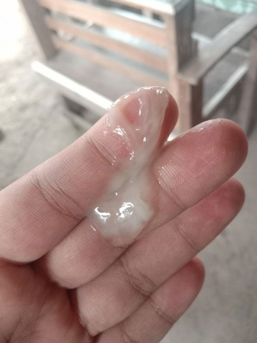 ปวดเเล้วหาย+ท้องเเข็ง เจ็บหัวหน่าว
มีมูกเเบบนี้ออกมาหมายถึงอะไรคะ