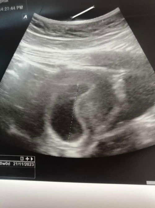 สวัสดีค่ะแม่ๆ อยากสอบถามคุณแม่ค่ะ