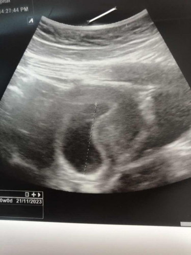 สวัสดีค่ะแม่ๆ อยากสอบถามคุณแม่ค่ะ