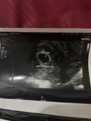 9 weeks pregnancy but 6 weeks scan