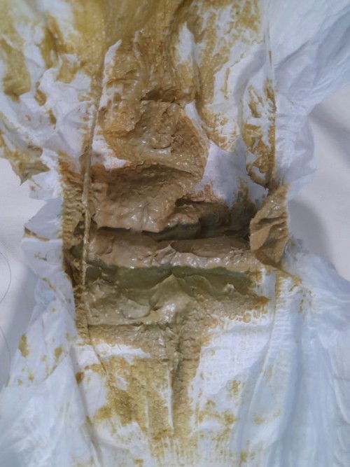 Bayi 4 bulan bab nya warna kehijau" an gini apakah gppa ?