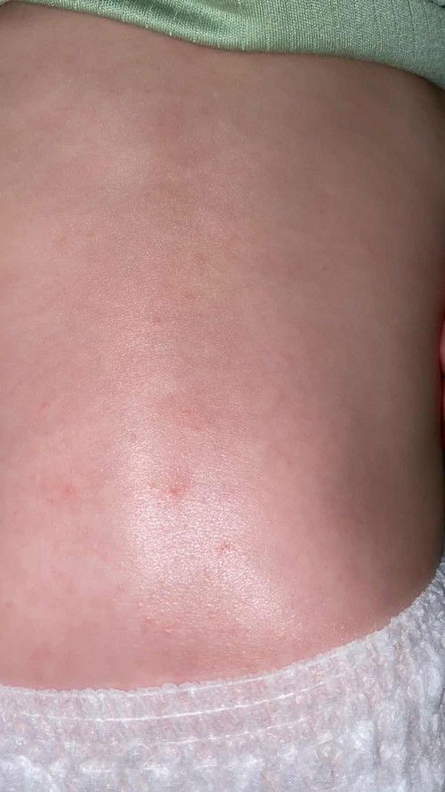 bentol gelembung air