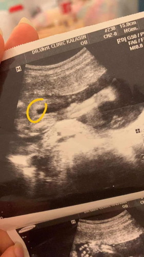 ช่วยดูหน่อยค่ะแม่ๆ