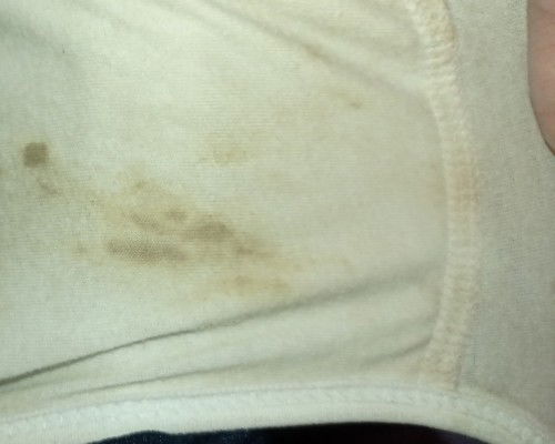 Flek pada celana dalam