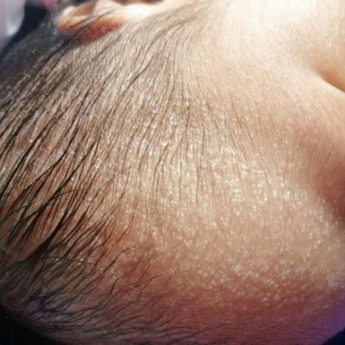 Butlig ni baby normal po ba