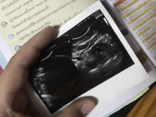 ขอบคุณสำหรับคำตอบค่ะ