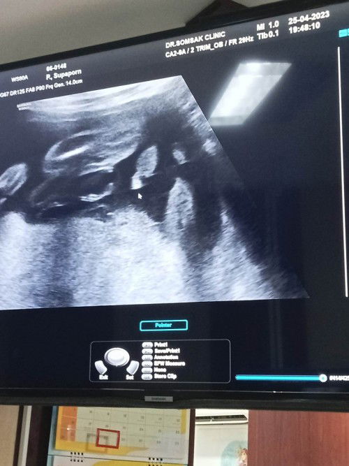 สอบถามค่ะแบบนี้ชายหรือหญิงคะ