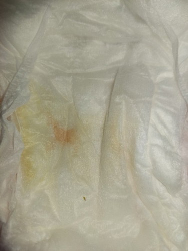 mga mii anu kaya itong sa diaper ng anak ko 😔