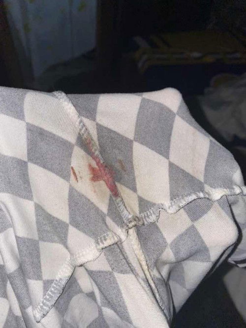 Hello mga mommies after 3hrs bago ko ma ie may lumabas kasi na na ganito pero sarado pa naman cervix